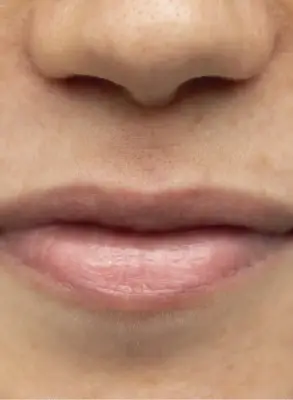 Primer plano frontal de labios naturales antes de una micropigmentación.