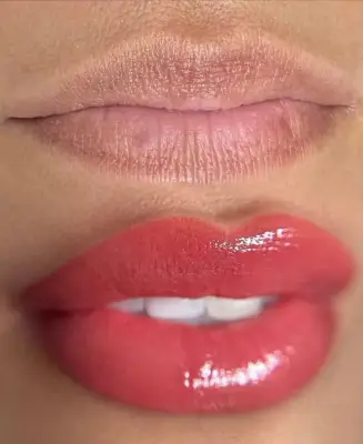 Comparativa de labios antes y después de micropigmentación con mayor definición y color.