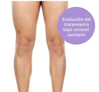 Piernas masculinas como referencia al tratamiento de depilación láser bajo control sanitario.