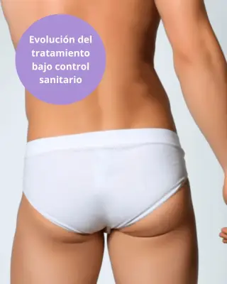 Zona lumbar y glúteos masculinos como referencia a depilación láser corporal.
