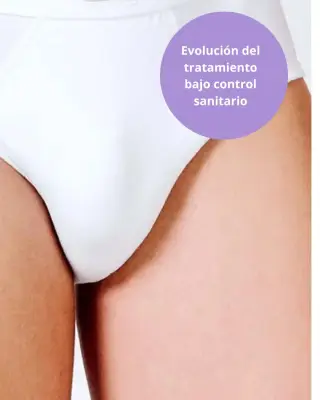 Zona de ingles femenina como referencia al tratamiento de depilación láser íntima.