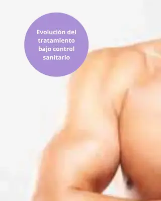 Zona superior de la espalda y hombro como referencia a depilación láser corporal.