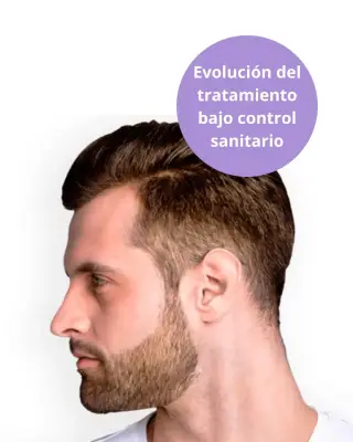 Perfil masculino con barba como referencia a depilación láser de barba y cuello.