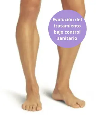 Piernas masculinas desde la rodilla como referencia a depilación láser.