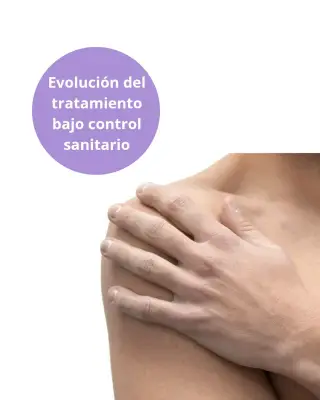 Mano masculina como referencia al tratamiento de depilación láser de manos y dedos.